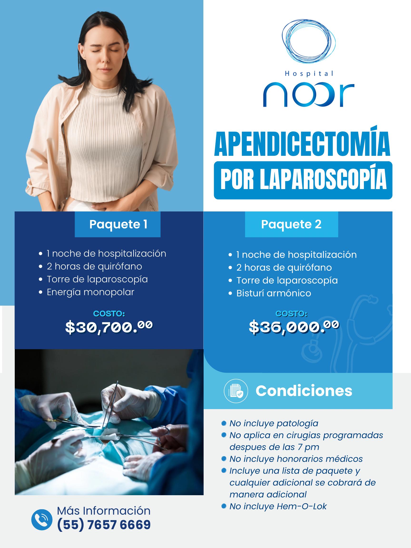 Paquete Apendicectomía