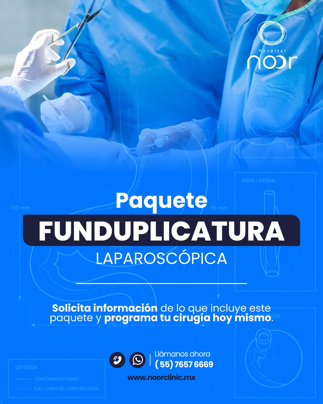 Paquete Funduplicatura Laparoscópica